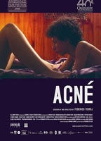 Acné (2008) Escenas Nudistas